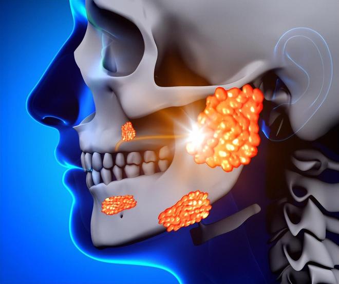 是缺水或是这几种疾病“找上门”口干是大病征兆？提醒：别以为(图4)