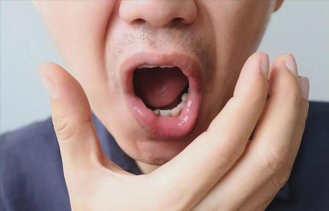 是缺水或是这几种疾病“找上门”口干是大病征兆？提醒：别以为(图9)